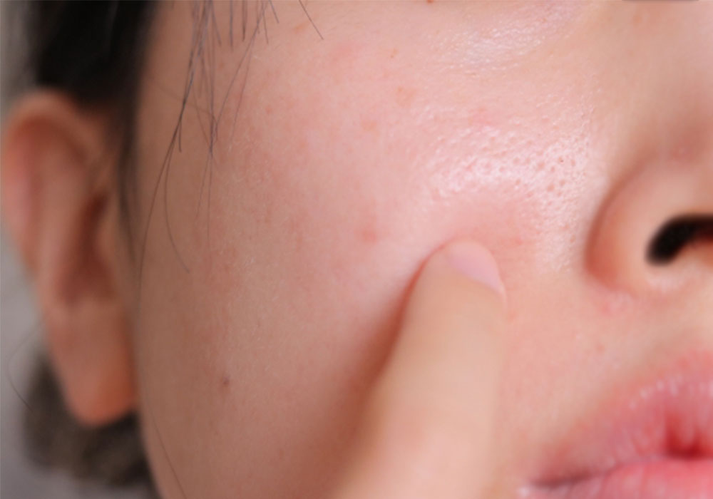 すっぴんを見せたくない女性　毛穴を気にしている女性　