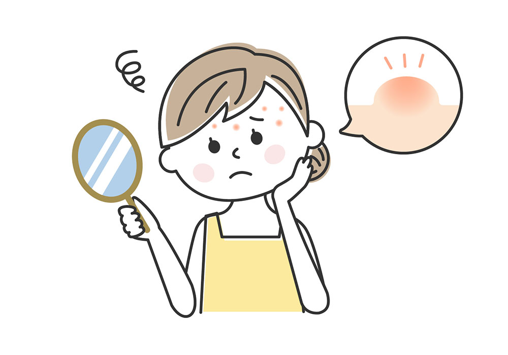 ニキビや肌荒れに悩む人
